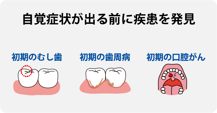 歯ぎしりの影響